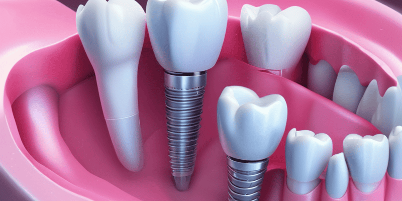Dental Implants Indications Quiz