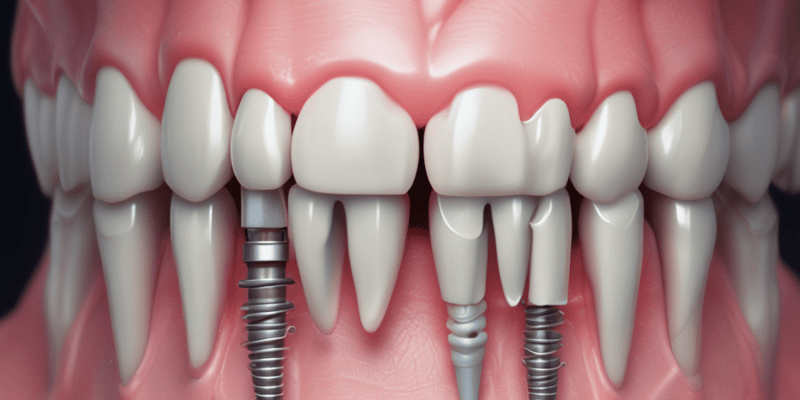 PROSTHETIC OPTIONS IN IMPLANT