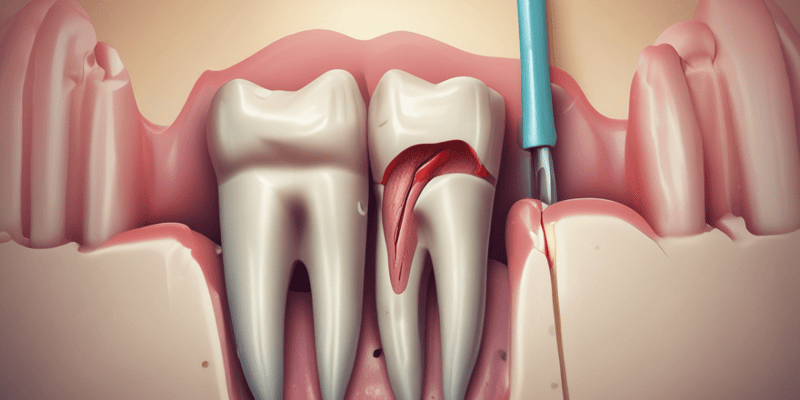 Root Canal Treatment: Cleaning and Shaping