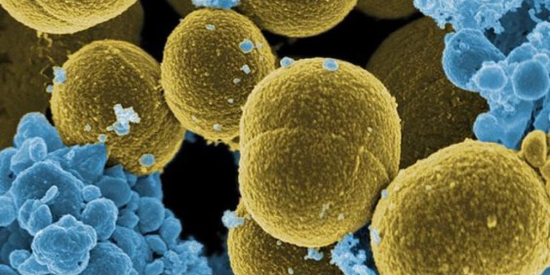 Bacteriología: Staphylococcus aureus