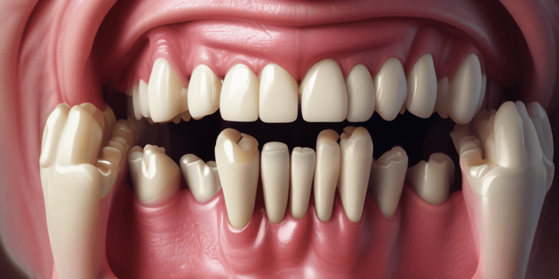 Periodontal Disease: Immunopathogenesis