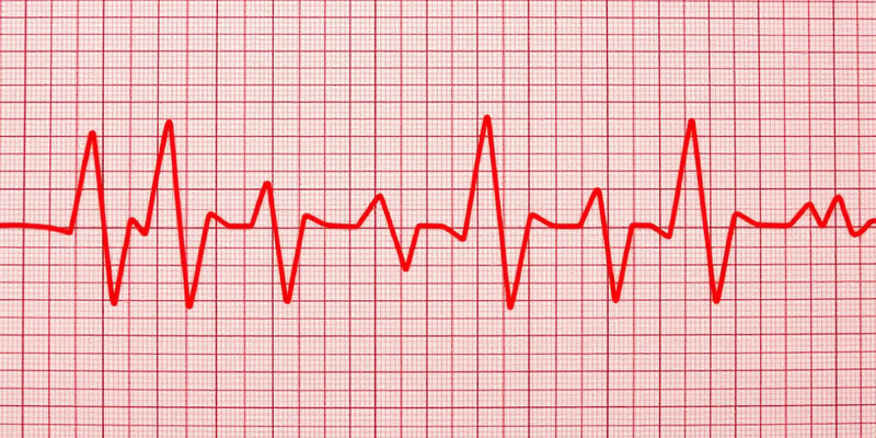 Abnormal Sinus Rhythms and Tachycardia