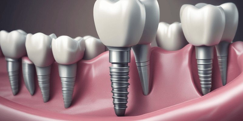 Dental Implants Chapter 1