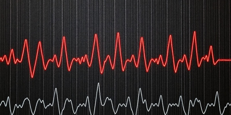 Electrocardiograma (ECG)