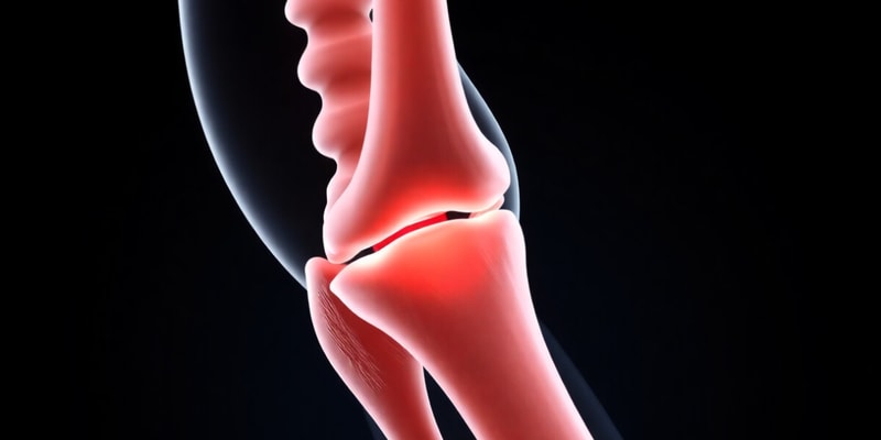 Osteokinematics and Arthrokinematics Quiz