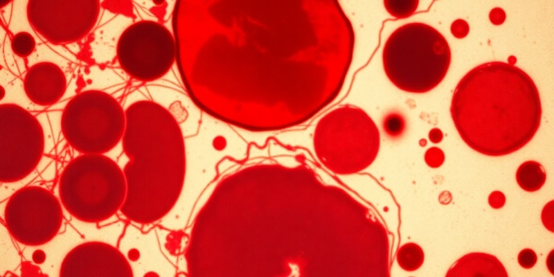 Hematology: Supravital Stains and Erythropoiesis