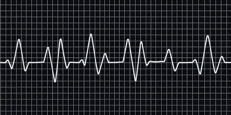 Electrocardiograma (ECG) - Derivaciones