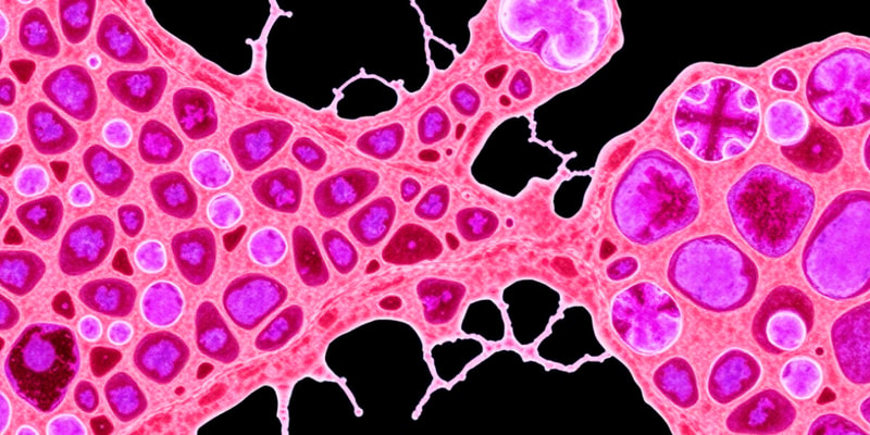 Connective Tissue Overview and Components