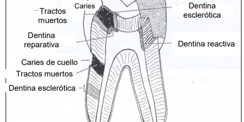 Tema 31