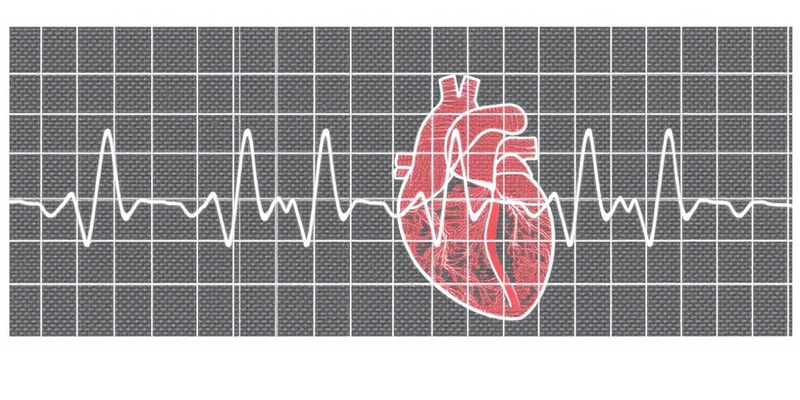 Electrocardiograph Standard Limb Leads