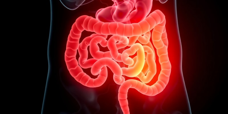 Intestinal Disorders: Appendicitis Overview