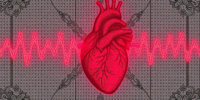 ECG Interpretation Basics