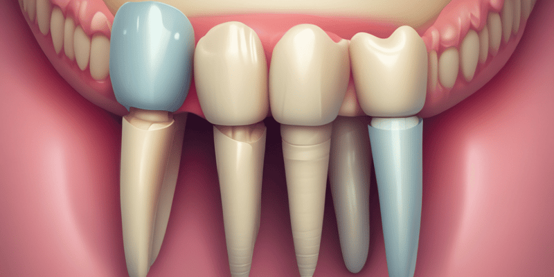 Dentisterie : Conception d'Onlays